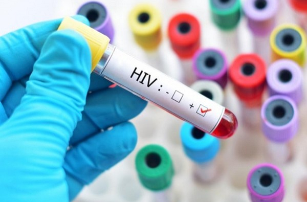 Nhiễm HIV